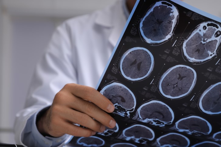 Ways to Educate Others About Your Brain Injury